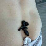 Zdjecie 2. Pijawki zastosowane do leczenia rwy kulszowej - LeczNaturalnie.pl