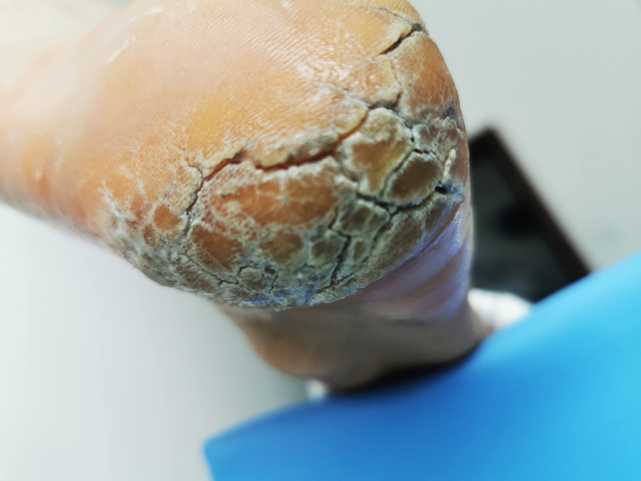 nk user gallery 5 - LeczNaturalnie.pl